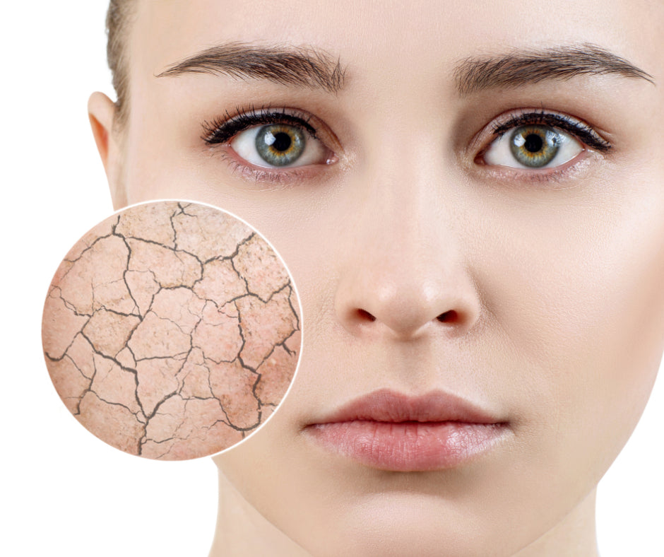 Woman resting while considering the relationship between stress and skin health
