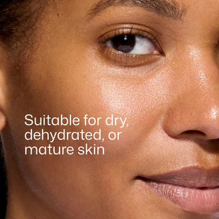 Close-up of a model wearing EltaMD UV Daily Hydration+ Tinted SPF 50 on dry, dehydrated skin