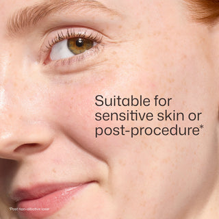 Close-up of a model with sensitive, redness-prone skin wearing EltaMD UV Skin Recovery Green Tint Broad Spectrum SPF 50